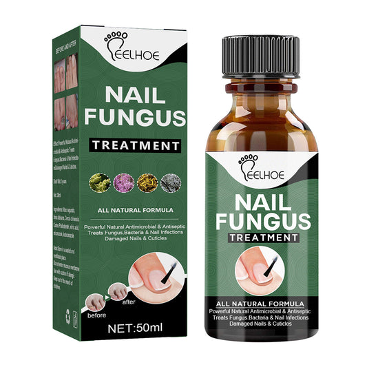 Nail Fungus Serum bottle for fungal nail treatment in Pakistan